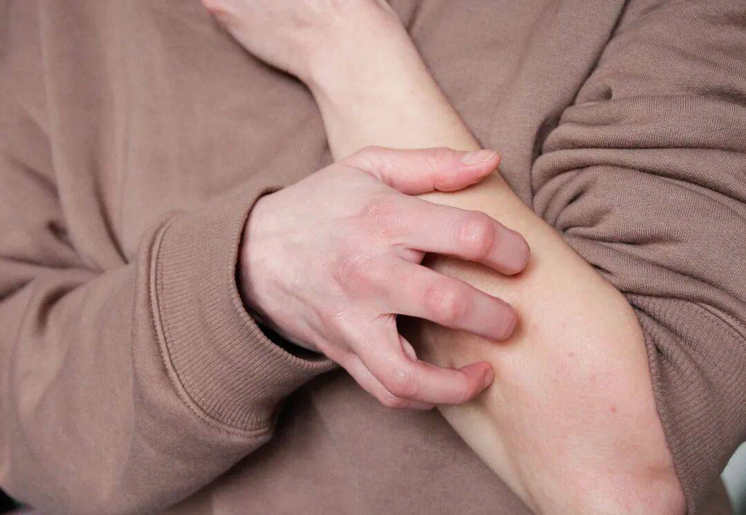 皇冠信用網开户_事发上海街头!女子突然浑身肿胀皇冠信用網开户,陷入昏迷...医生:建议随身携带肾上腺激素笔
